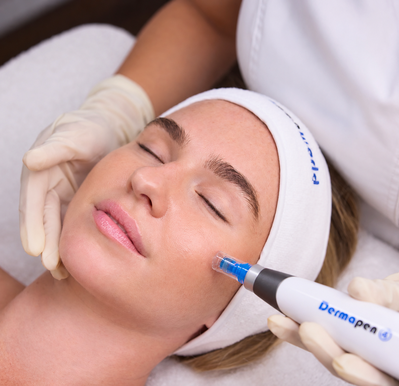 Skin Needling